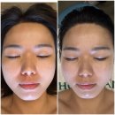 얼핏 | 부산 동래 리프팅 고민하다가 인투더래빗홀스파에서 얼핏온다 받고 온 후기