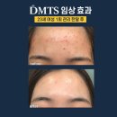 피부맑음 이미지