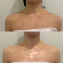 (주)세라젬 수원조원점 | 수원 인계동피부관리 '키웰 수원인계점' 웨딩관리 탄력관리 후기