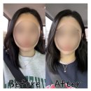 휴앤미의원 네이버블로그