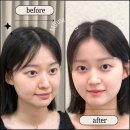 하은옷장 | 얼태기 타파할 수 있는 나의 얼굴 리즈 되찾는 방법 알려드릴게요