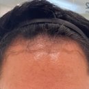 모디헤어플란트의원 이미지