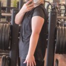 (주)아비스모 생활건강 | 성남 팔뚝 지방추출주사 12바틀 뽑고 온 달스 주사 리얼 후기 (다음날 일상생활 가능! 비포&amp;애프터 사진)