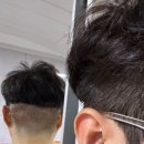 고요의원 | 비절개 모발이식 일주일차 후기 비포&애프터 "압구정 채우다의원"