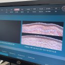 GS25산청스마일점 | 내돈내산 스마일라식 프로 수술 후기 (강남 지에스안과 GS안과 | 이성우 원장님) +지인할인 코드 | 일반...