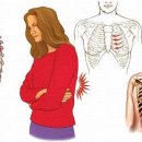 링게이트 이미지