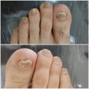 레푸스 앤 두두네일 이미지