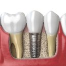 디아트치과의원 이미지