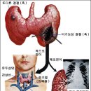 갑상선은 목 앞부분 중앙에 위치한 내........... 이미지