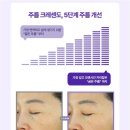 결 | PDRN 세럼 물광결 변화 후기