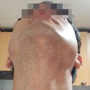엘페 | 온뜰에피움 토탈 웨딩촬영 청담 엘페라 수염 많은 신랑 헤어메이크업 후기