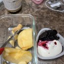 294-2 | 복부 무한람스 + 러브핸들 람스 2번 후기 | 비용·통증·효과·사이즈 변화 솔직 공개