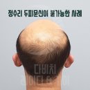 디에스엠피 이미지