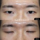 뷰라밸성형외과의원 이미지