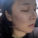 리엘에스테틱 - 공주시 | 부천잡티관리 리엘에스테틱에서 기미 옅어지고 온 후기