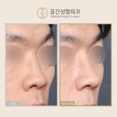 케이스코 이미지