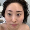 예봄인테리어 | 평택역 평택동 예봄뷰티 평택웨딩관리 3v윤곽관리