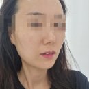 6543 | 동대구피부관리 뷰티로다 동대구점 후기