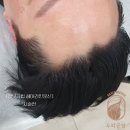 두피공방헤어라인