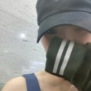 아우름치과의원 | 타투 제거 하고 온 후기 [1회차 이틀차] 내돈내산으로 문신제거 1회차 후기