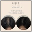 영앤유 | 부천에서 가장 유명한 부천시청 영앤유 SMP(두피채움) 후기