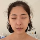 1385 | 대전 신부관리 아로뮤에스테틱 비대칭완화와 작은얼굴 윤곽관리 후기