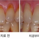 상아플란트치과 이미지