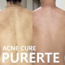 퓨어르떼(PURERTE) 네이버블로그