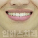 인비스치과의원 이미지