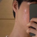 모랑뷰티 | [내돈내산] 수영장 물에 뒤집어진 여드름 모공 피부 구원템! 올메라 스팟 클렌저 찐 후기