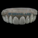 더블유치과기공소 이미지