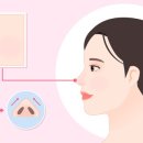디엘의원 네이버블로그