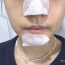다이소 피지클리너 메디필 엑스트라 슈퍼 9 플러스 가격, 효과, 사용후기, 사용법