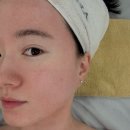 더뷰티아미고 - 노원구 상계로1길 54-3 | 일산피부관리 아미고 에스테틱 트러블피부관리 단골약속 찐후기