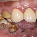 이안치과기공소 이미지