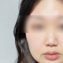 양군피어싱 이미지