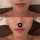 루체떼 | 범일역 윤곽관리 루체떼에스테틱 작은얼굴관리 후기