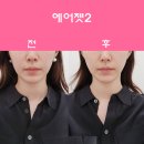 잠실예쁨주의쁨의원 이미지