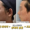 역발산센터 네이버블로그