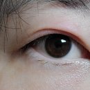 서울베스트안과의원 이미지