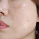 인치바이인치_LPG엔더몰로지 인천부평점