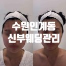 경기도 수원시 팔달구 세지로152번길 7-20 (인계동) | 수원인계동신부웨딩관리 받고 달라진 윤곽라인｜인계동피부관리 더라르떼 솔직후기