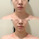 옐로도트/Yellowdot | 대전 두피관리샵 월평동 옐로도트에서 두피근막관리 받고 온 후기