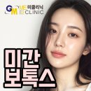 강남 누드죤빌딩 | 미간보톡스후기 전후 탄력 효과 잘하는곳 비교