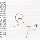 흉곽출구증후군(Thoracic Outlet Syndrome) 이미지