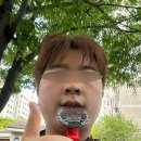 청주 셀린의원 - 주근깨 치료(피코토닝) 10회 내돈내산 솔직 후기 🔥