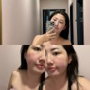 서초피부관리 ‘노바에스테틱 교대본점' 피부측정맞춤케어 윤곽관리 후기