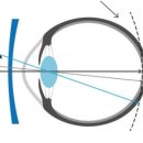 다비드안경 이미지