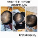 큐사랑신 네이버블로그