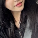 [광주 보조개수술 1달차 후기] 광주 보조개수술 비절개 x 절개!내돈 내산 보조개 수술